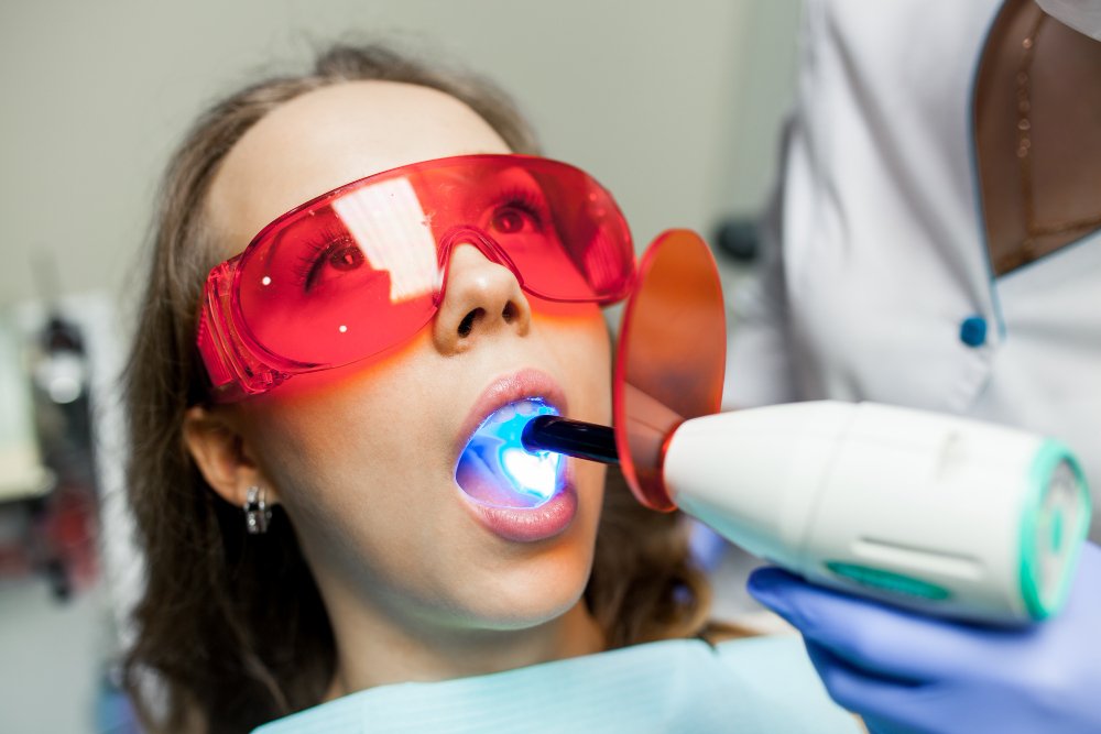 Laser Gum Contouring in Falls Church: A Complete Guide to a More Confident Smile